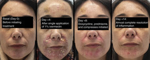 Clinical pictures of the patient.