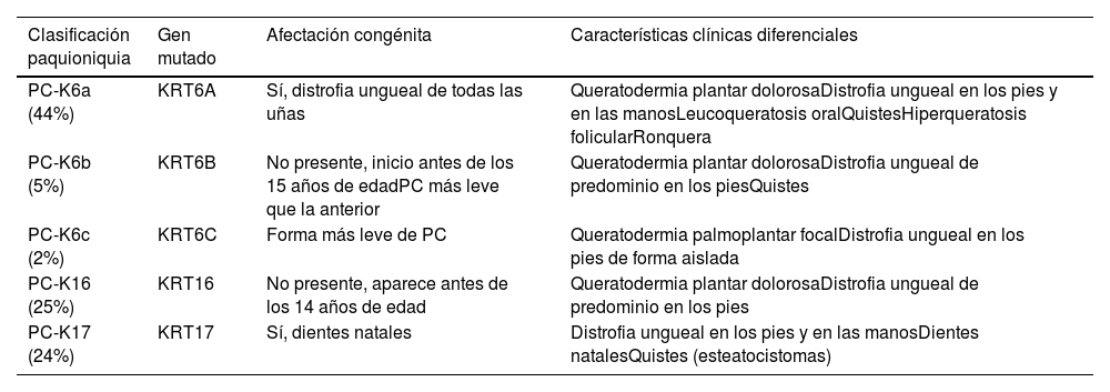 Tablas