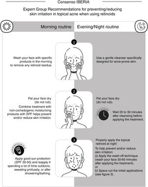 Recommendations from the expert group to prevent/reduce skin irritation in the topical treatment of acne with retinoids.