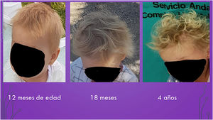 Niña con pelo corto, rubio, seco y siempre despeinado.