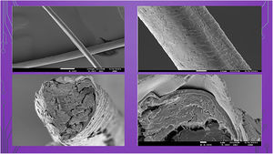 Microscopía electrónica, Pili trianguli et canaliculi. (Centres Científics i Tecnològics Universitat de Barcelona).