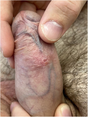 Patient