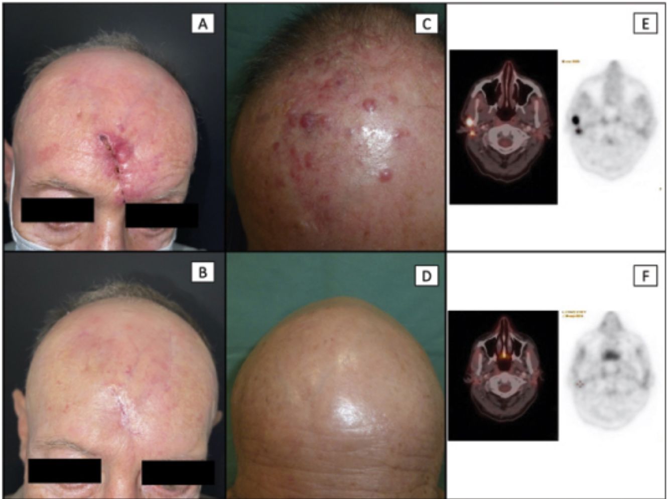 fig0010