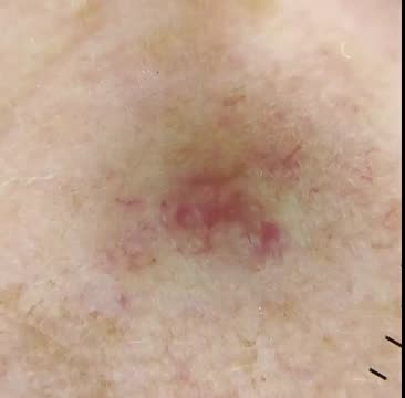 https://ars.els-cdn.com/content/image/1-s2.0-S0001731024009128-mmc2.mp4