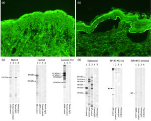(a, b) Indirect immunofluorescence images. (a) Patient