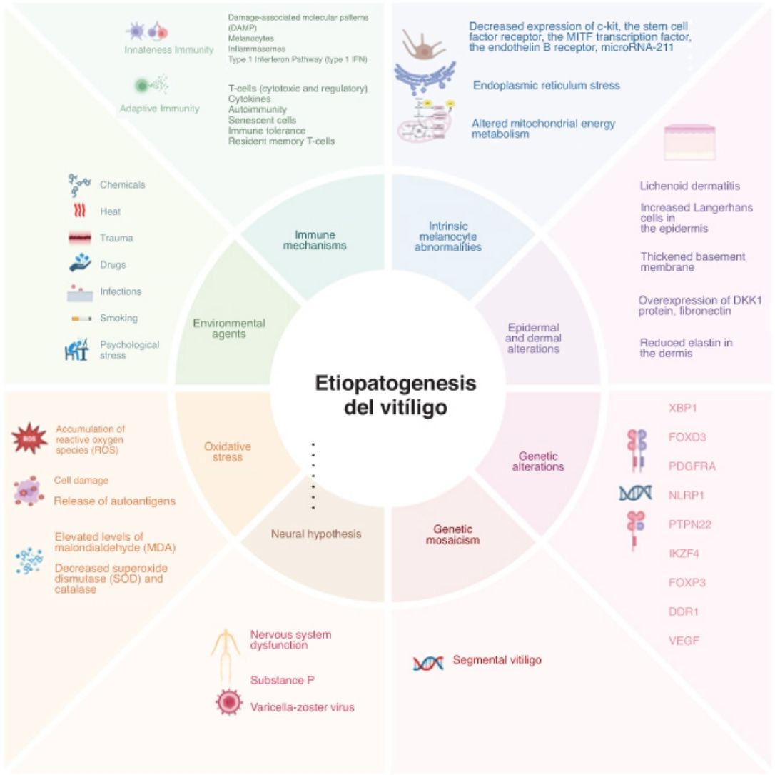 New Insights on the Etiopathogenesis of Vitiligo