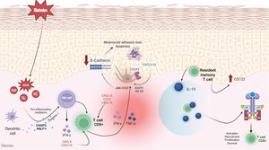 Etiopathogenic mechanisms of vitiligo. This figure illustrates all the important keys of how a molecular cascade is triggered, starting with increased melanocyte susceptibility to oxidative stress, which, in the presence of a susceptible genetic basis, leads to immune system activation. CD8+ T cells produce various cytokines such as IFN-γ. The binding of IFN-γ to its receptor activates the JAK-STAT pathway and causes the secretion of CXCL9 and CXCL10. CCL5: chemokine ligand 5; CXCL9: CXC chemokine ligand 9; CXCL10: CXC chemokine ligand 10; CXCL12: CXC chemokine ligand 12; CXCL16: CXC chemokine ligand 16; CXCR3: chemokine receptor type 3; DAMP: damage-associated molecular pattern; IFN-γ: interferon-γ; JAK: janus kinase; MAPK: mitogen-activated protein kinase; NF-kB: nuclear factor kappa light chain enhancer of activated B cells; NLRP1: NOD-like receptor family pyrin domain containing 1 (NLRP1); TNF-α: tumor necrosis factor alpha; ROS: reactive oxygen species; STAT1: signal transducer and activator of transcription 1.