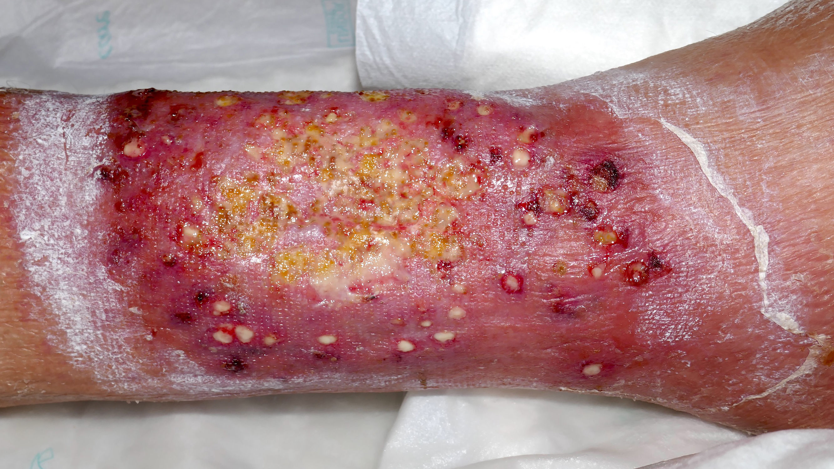 fig1