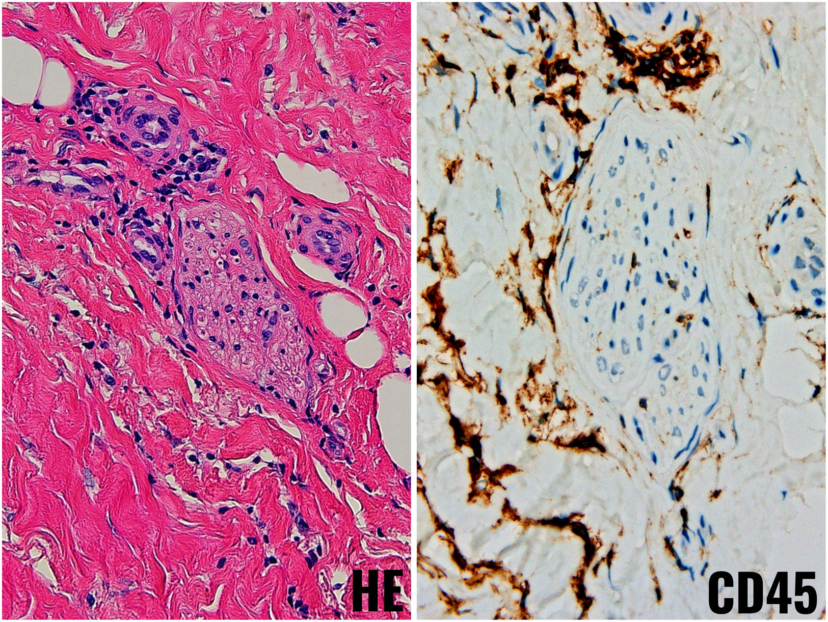 fig0015