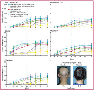 Patient response by treatment group. (A) Response based on SALT ≤20. (B) Response based on SALT ≤10. (C) PGI-C response (“moderately improved” or “much improved”). (D) Eyebrow response (≥2-grade improvement or a normal eyebrow assessment score of 3 in patients without normal eyebrows at baseline). (E) Eyelash response (≥2-grade improvement or a normal eyelash assessment score of 3 in patients without normal eyelashes at baseline). (F) Representative photos of a responder at week 24. SALT, Severity of Alopecia Tool; PGI-C, Patient