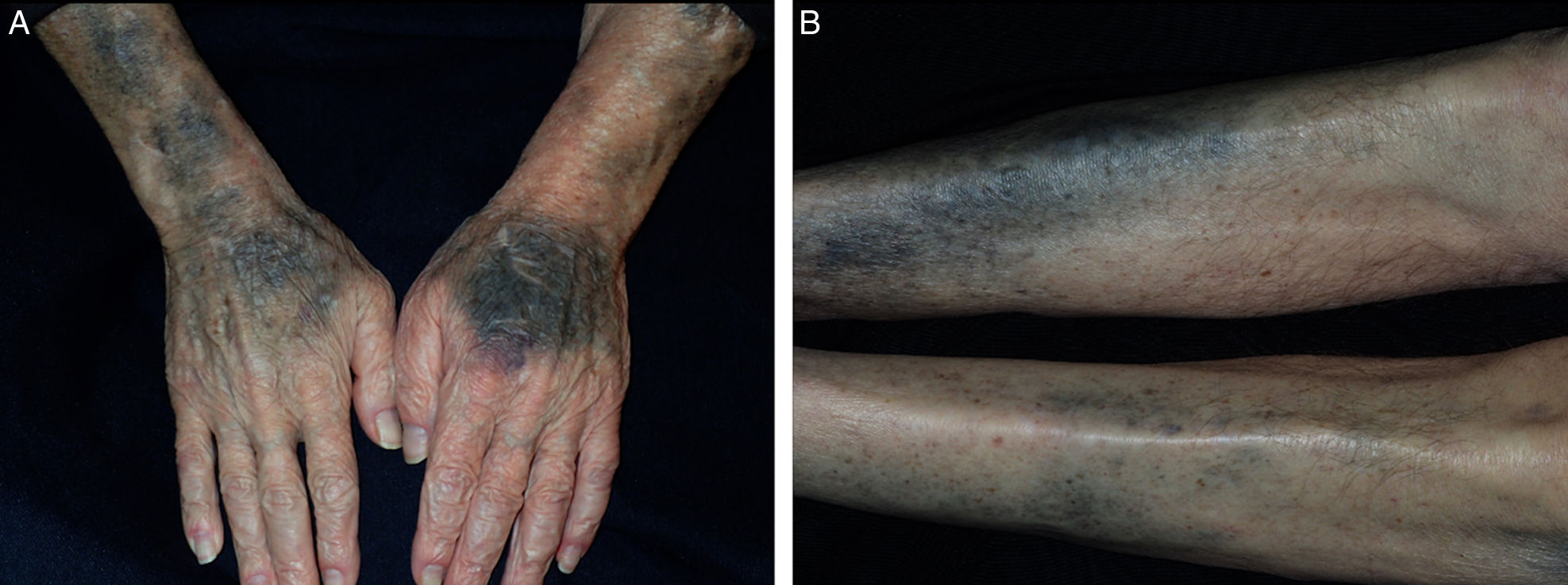 fig0005