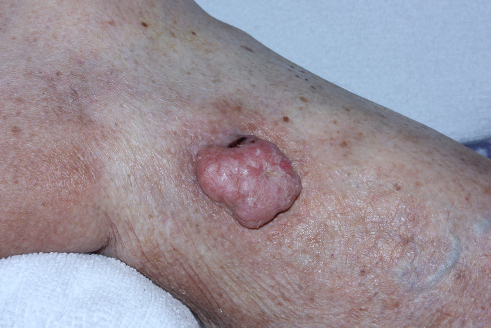 fig0005