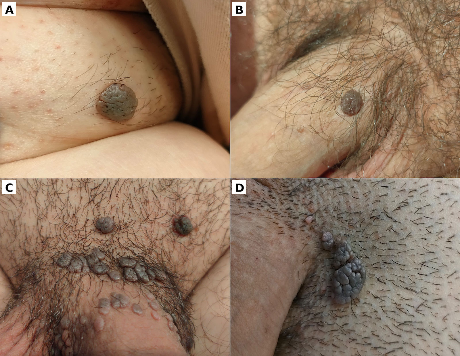 fig0010