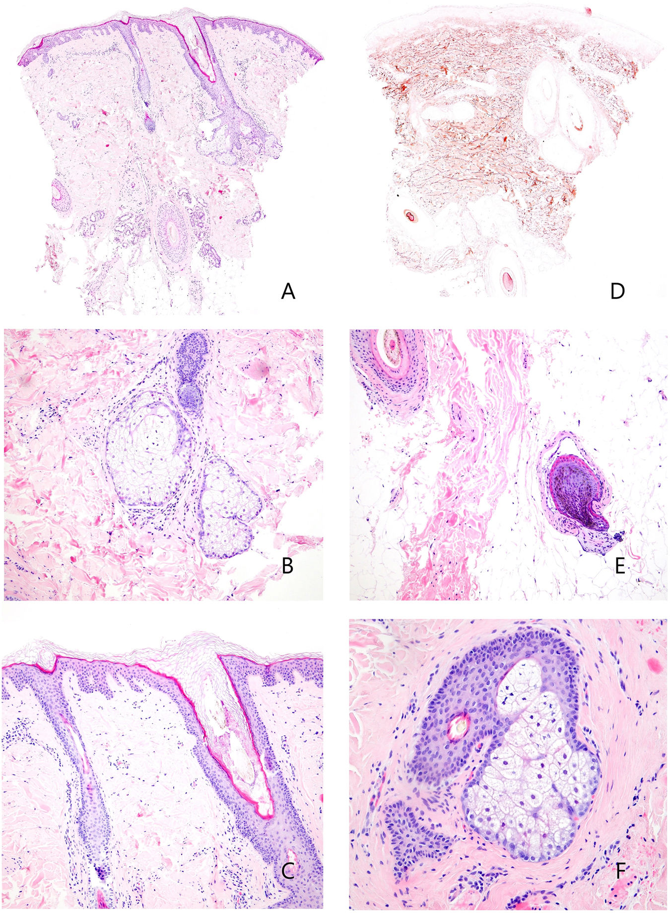 fig0010