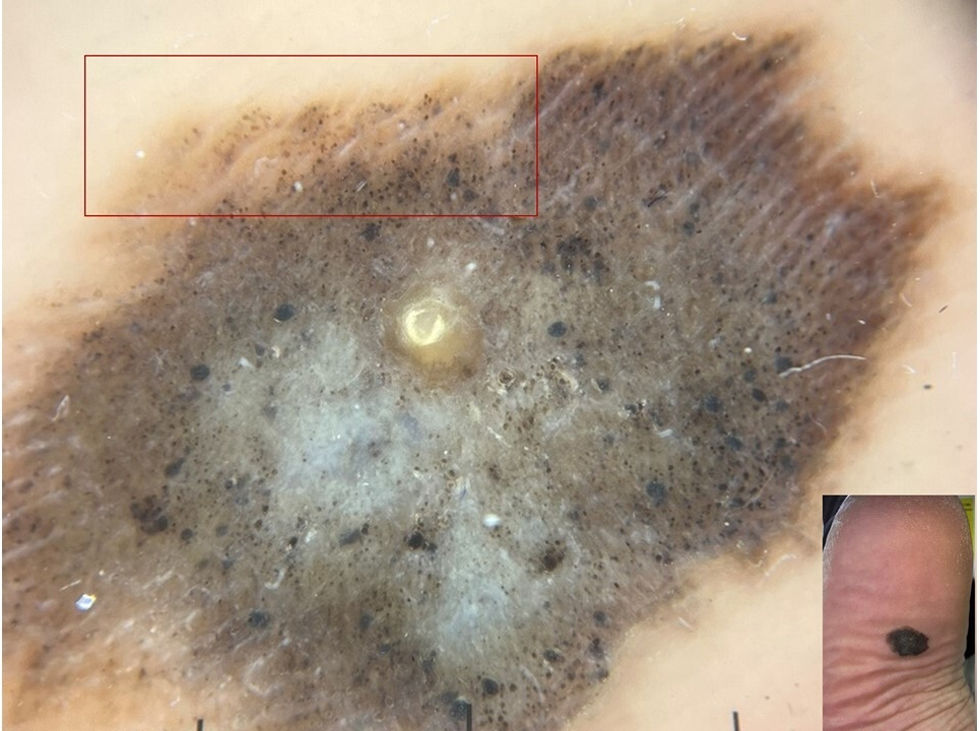fig0005