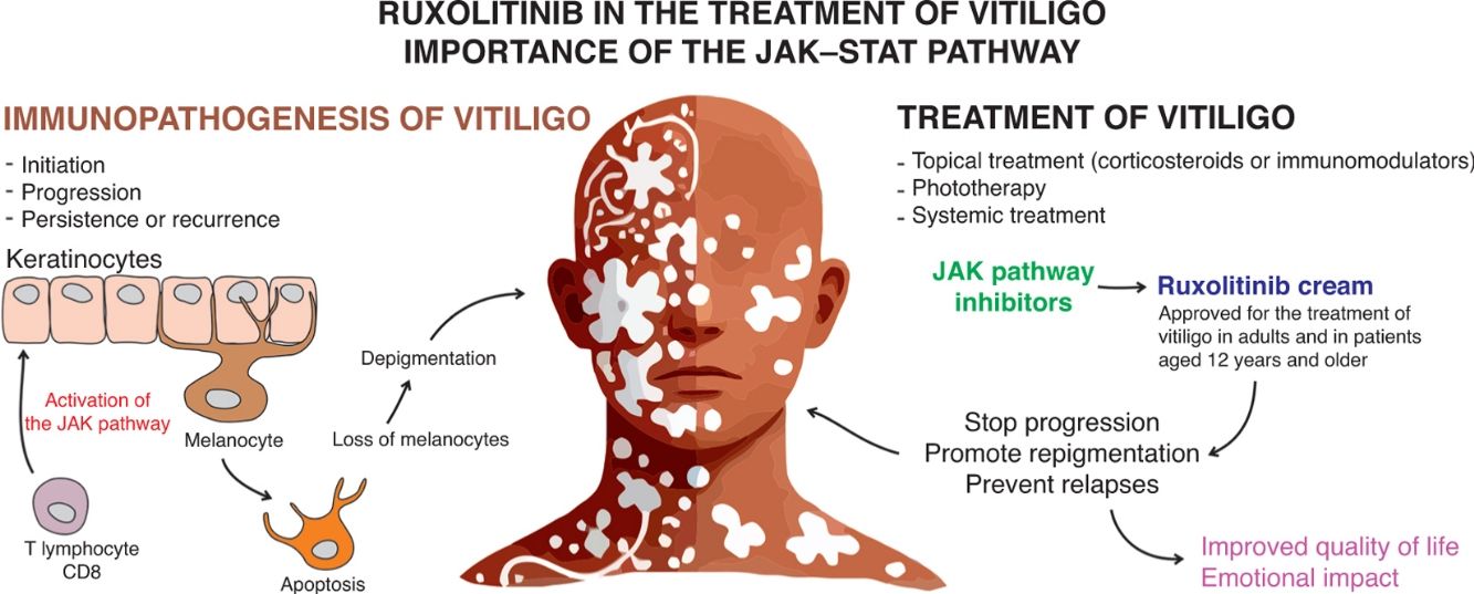 glutathione injections for skin brightening Glutathione Injections for Skin Whitening: Complete Guide