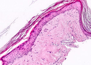 Histological image.