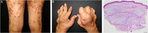 Fig. 1
