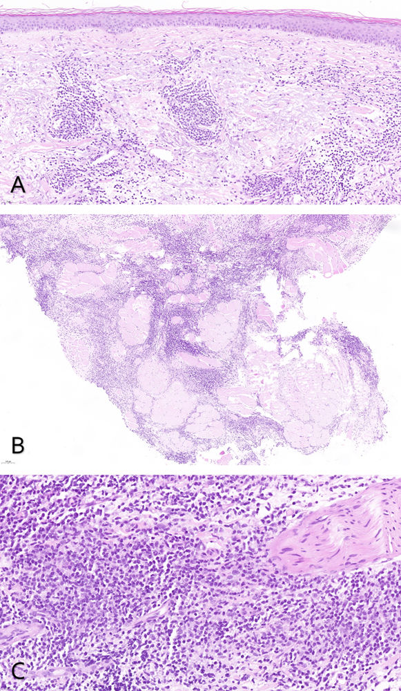 fig0010