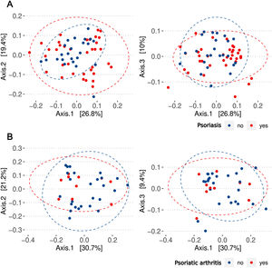 Beta diversity based on principal coordinates analysis (PCoA). (A) Beta diversity according to the presence (red) or absence (blue) of psoriasis. No clustering according to psoriasis diagnosis is observed. (B) Beta diversity according to the presence of psoriatic arthritis. No segregation of cases is observed according to this variable.