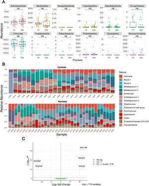Total abundance by phylum, relative abundance by species, and volcano plot for differential abundance analysis. (A) Total abundance by phylum. This panel shows total phylum-level abundance in both groups: psoriasis and control. The phylum Synergistota appears less abundant in psoriasis, although overall abundance is low in both groups. (B) Relative abundance by species. This panel displays the relative abundance of the different species in both groups: control (top) and psoriasis (bottom). (C) Volcano plot for differential abundance analysis. This plot shows the results of the differential abundance analysis. ASVs with no differences across groups are shown in green. ASVs with differential abundance in psoriasis are shown in red – lower abundance on the left and higher abundance on the right.