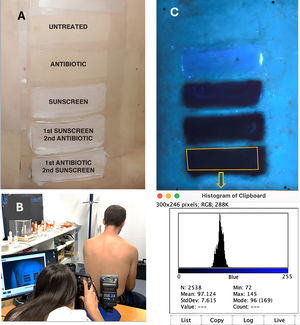 (A) Left paravertebral region divided into five 5cm2×2cm2 areas with the respective treatments applied. (B) UV photography device used to capture images of each volunteer