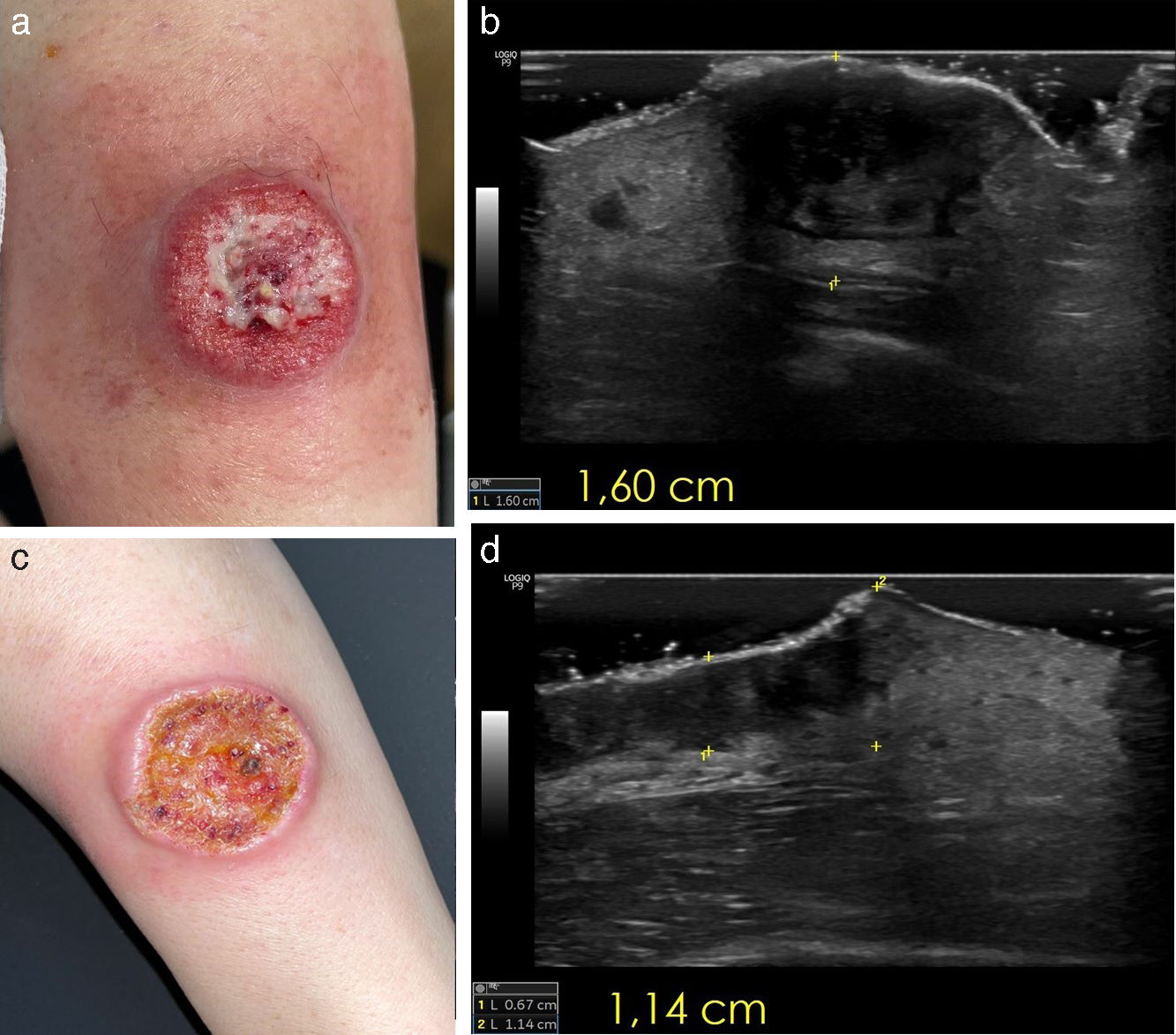 fig0005