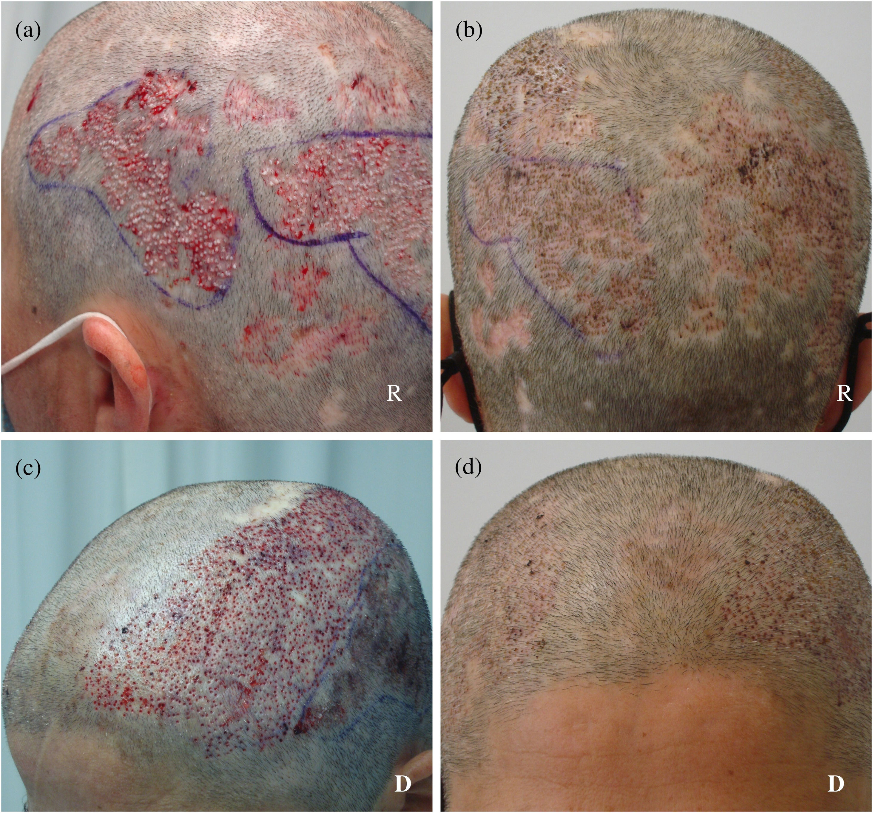 fig0010
