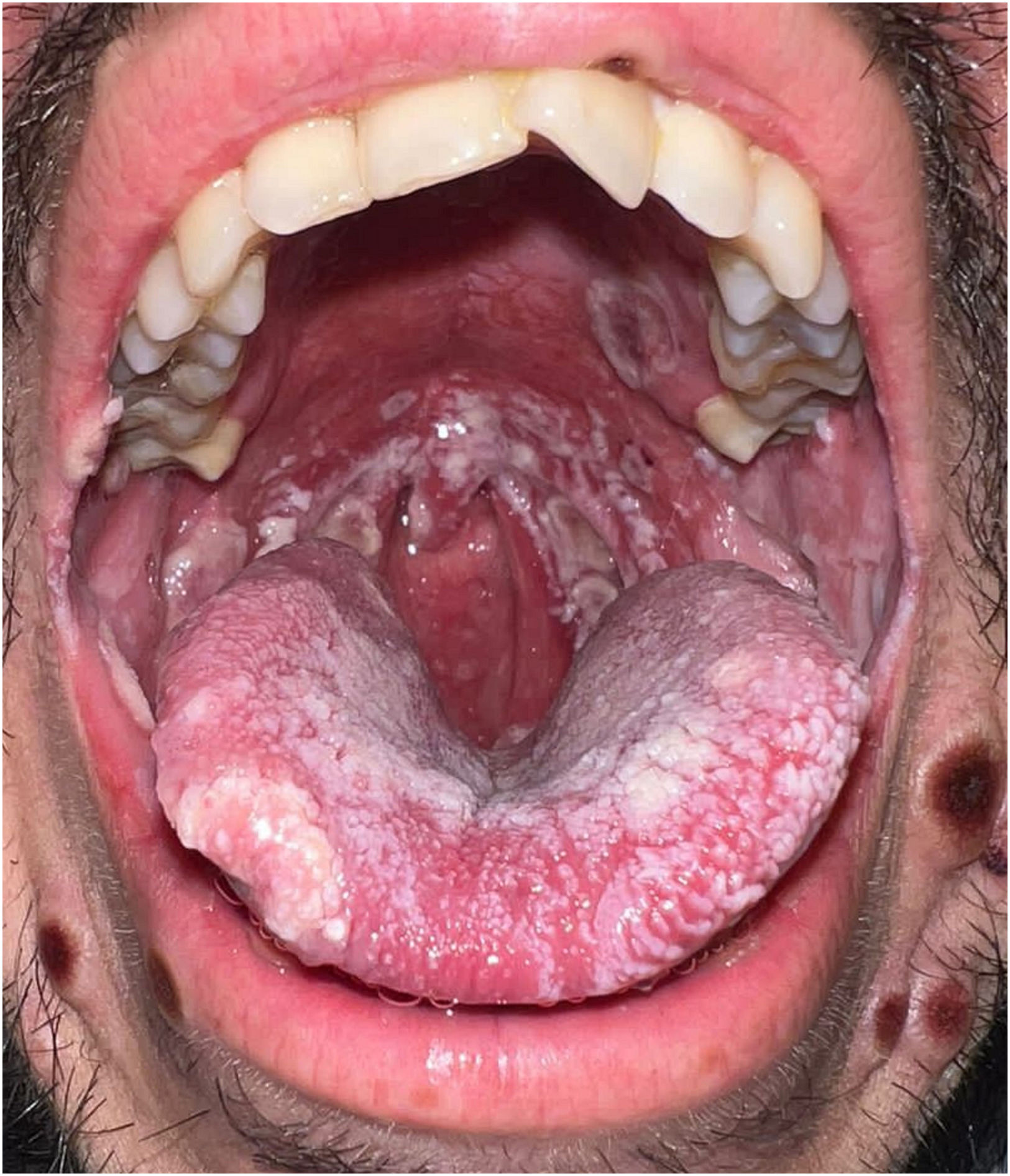 fig0005