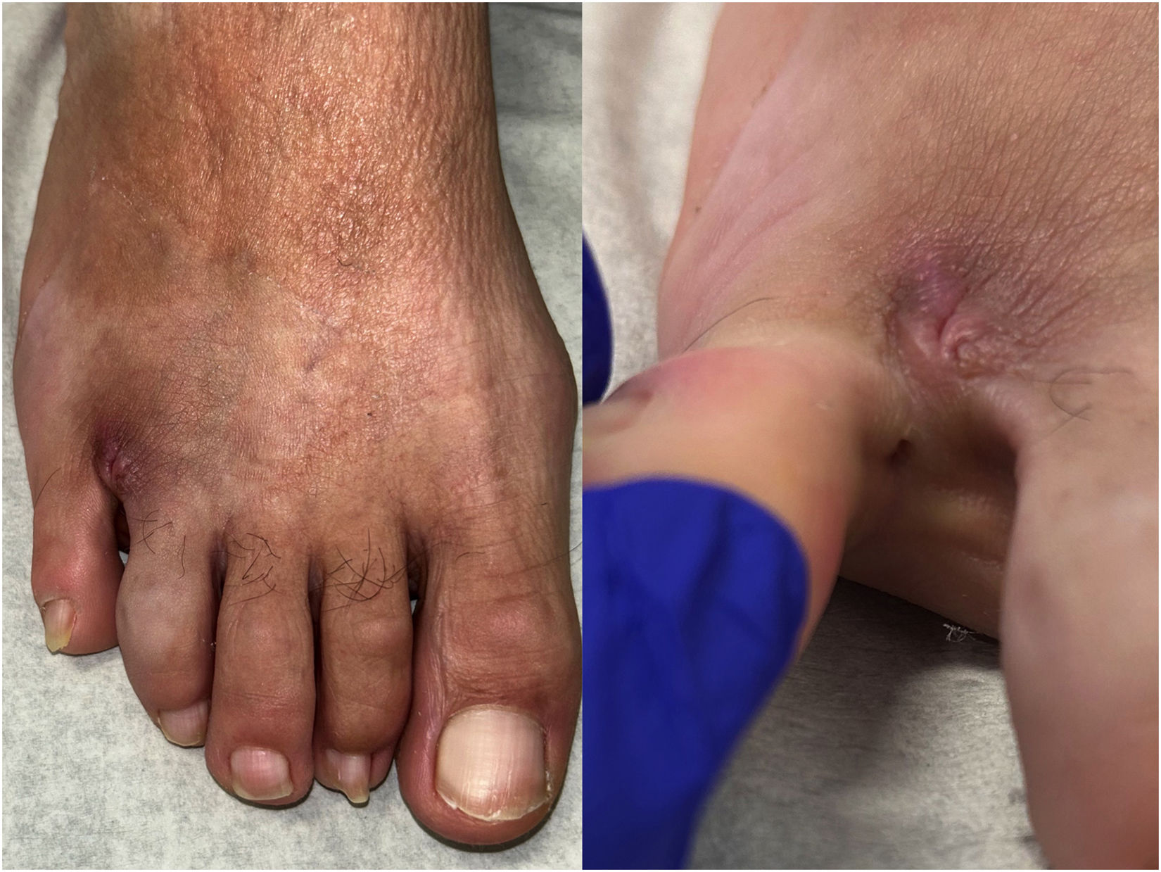 fig0005