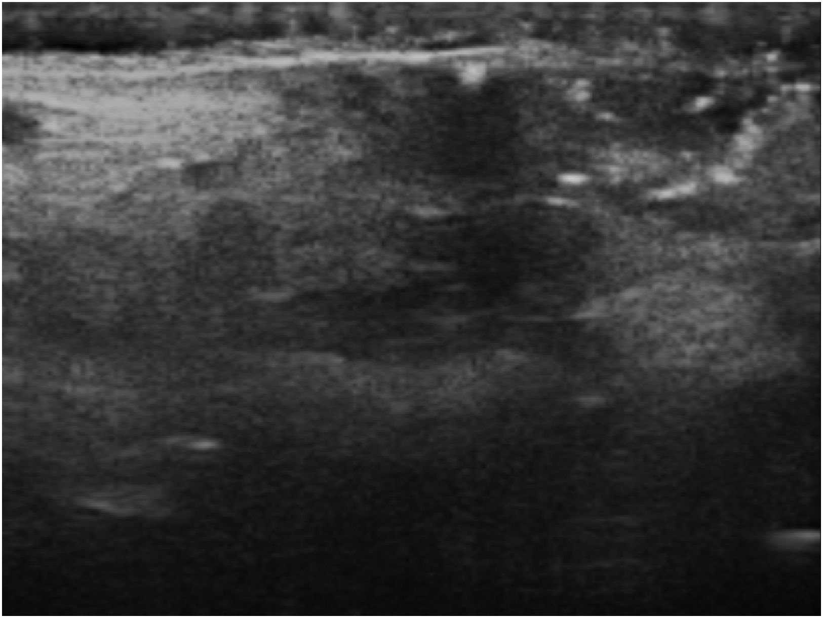 fig0010