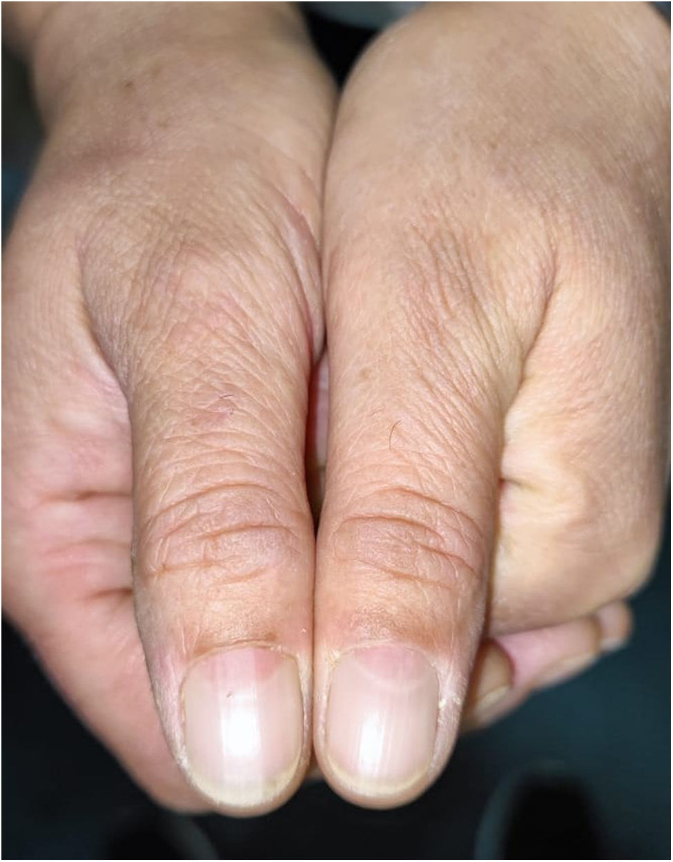 fig0005