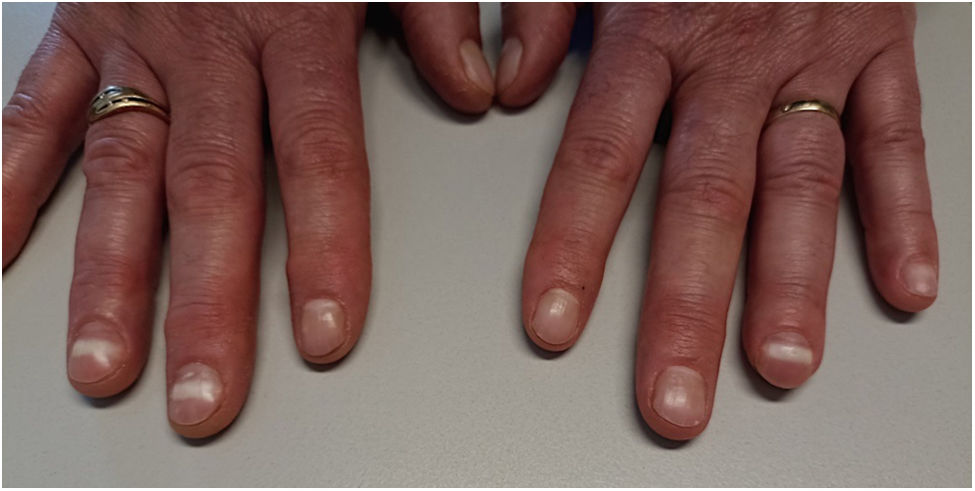 fig0010