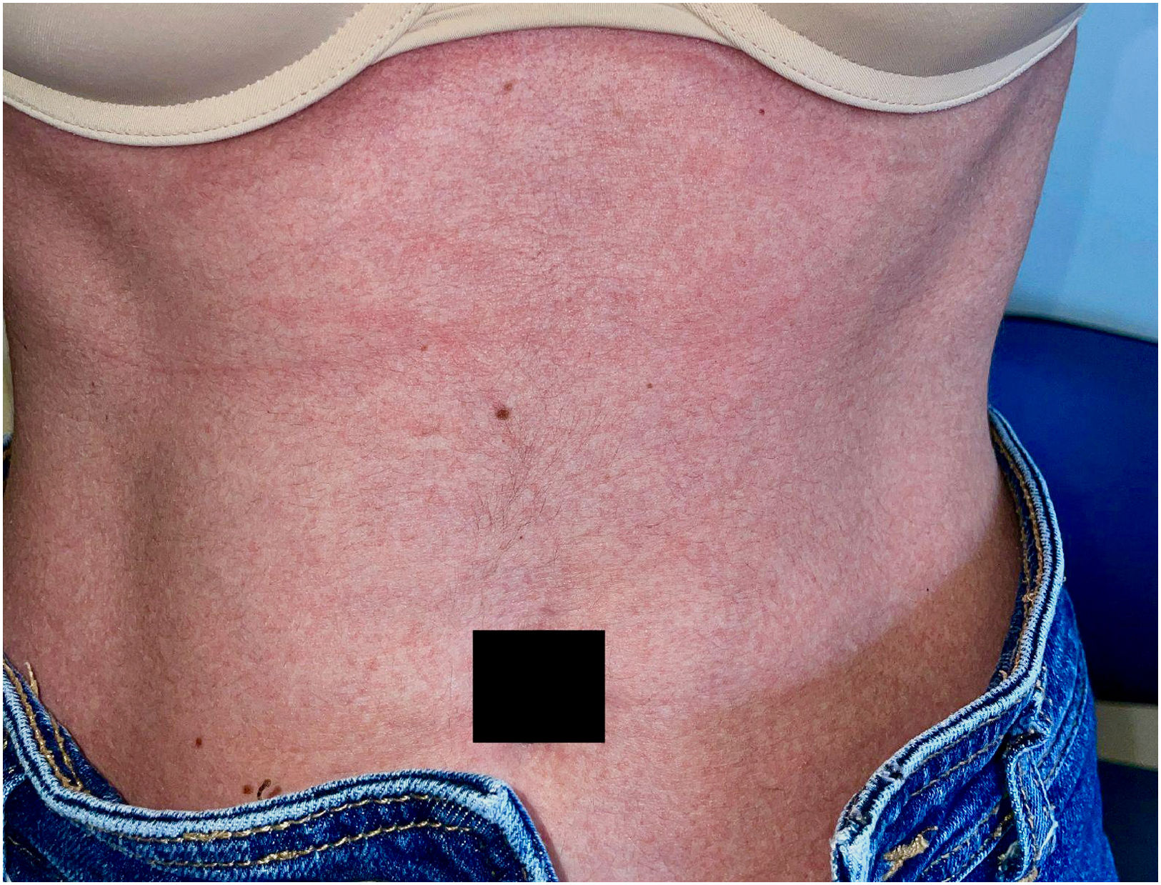 fig0005