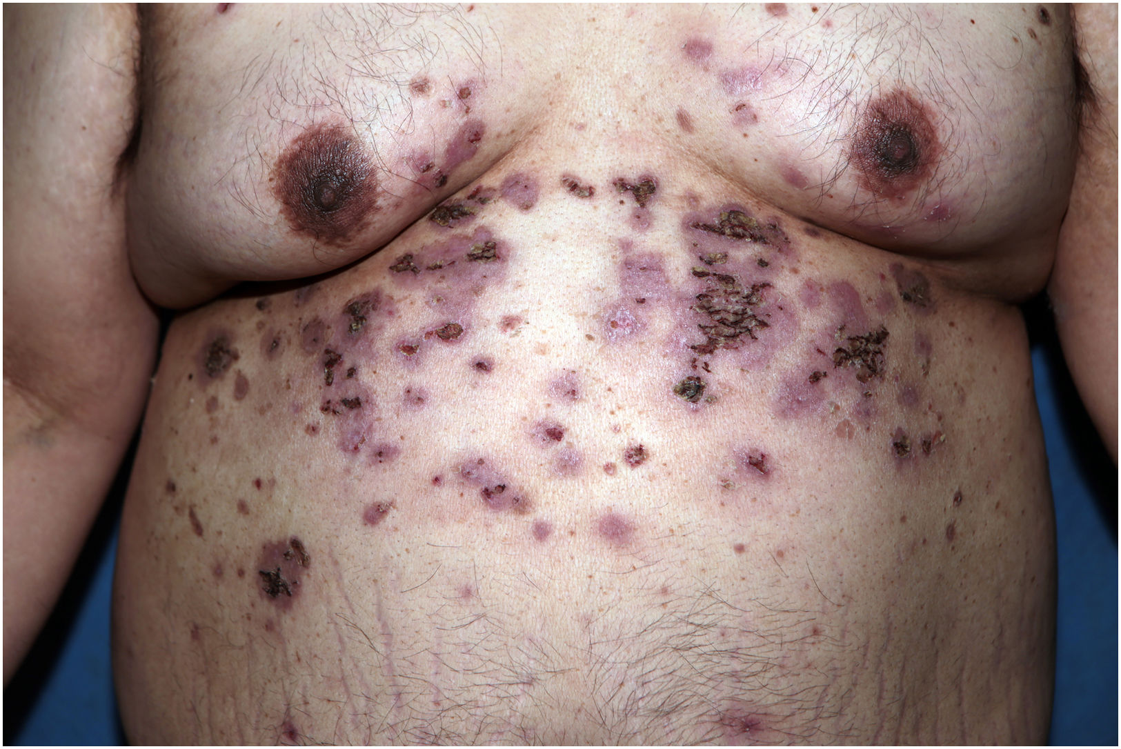 fig0010