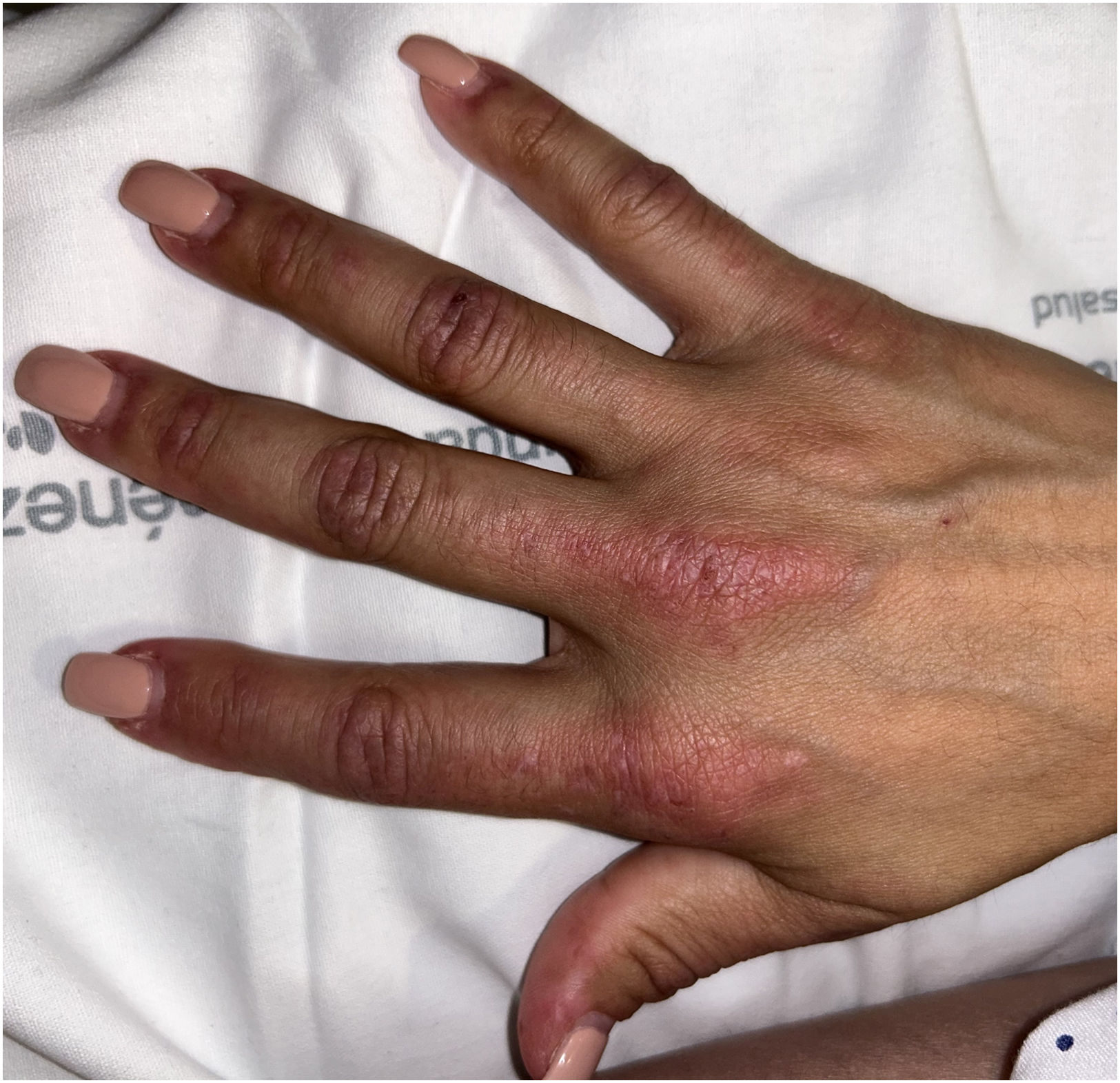 fig0005