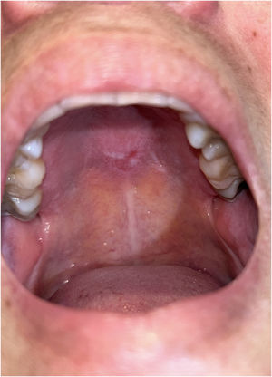 Fig. 2