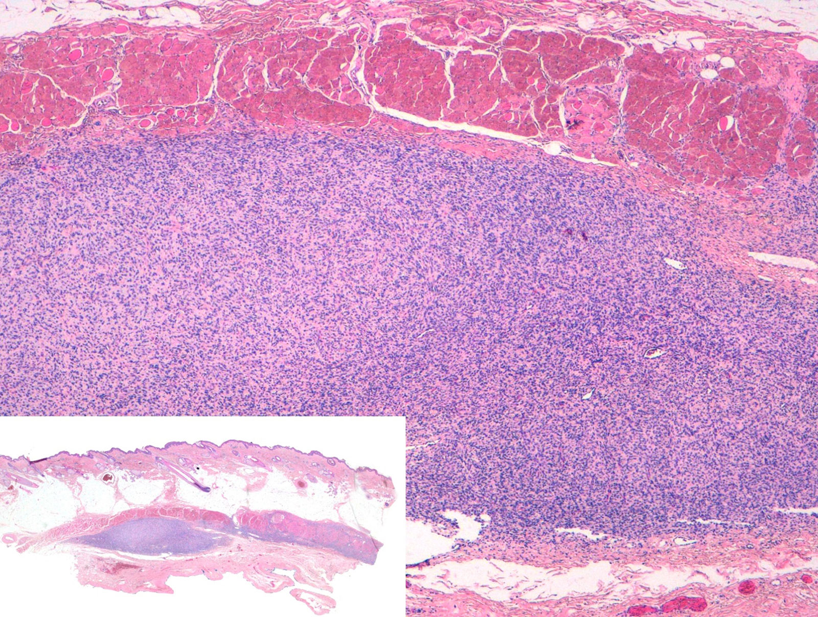 fig0010
