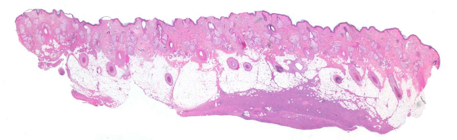 fig0020