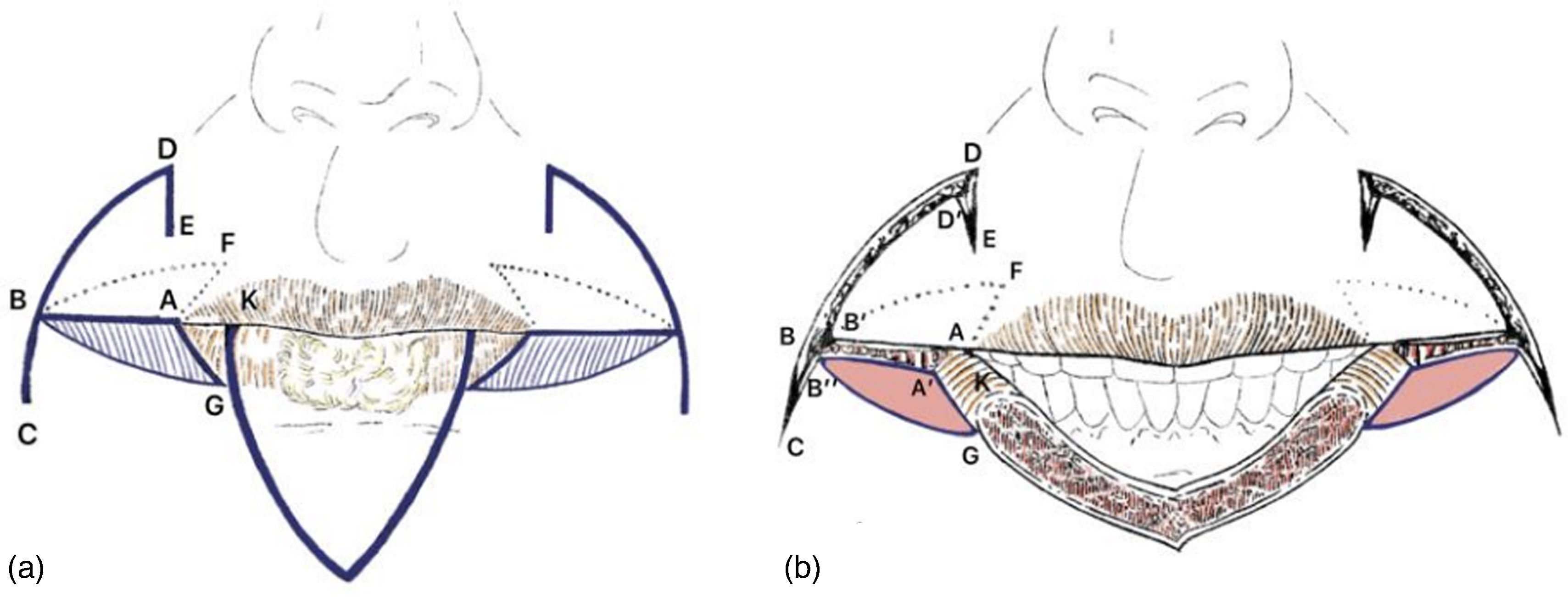 fig0005