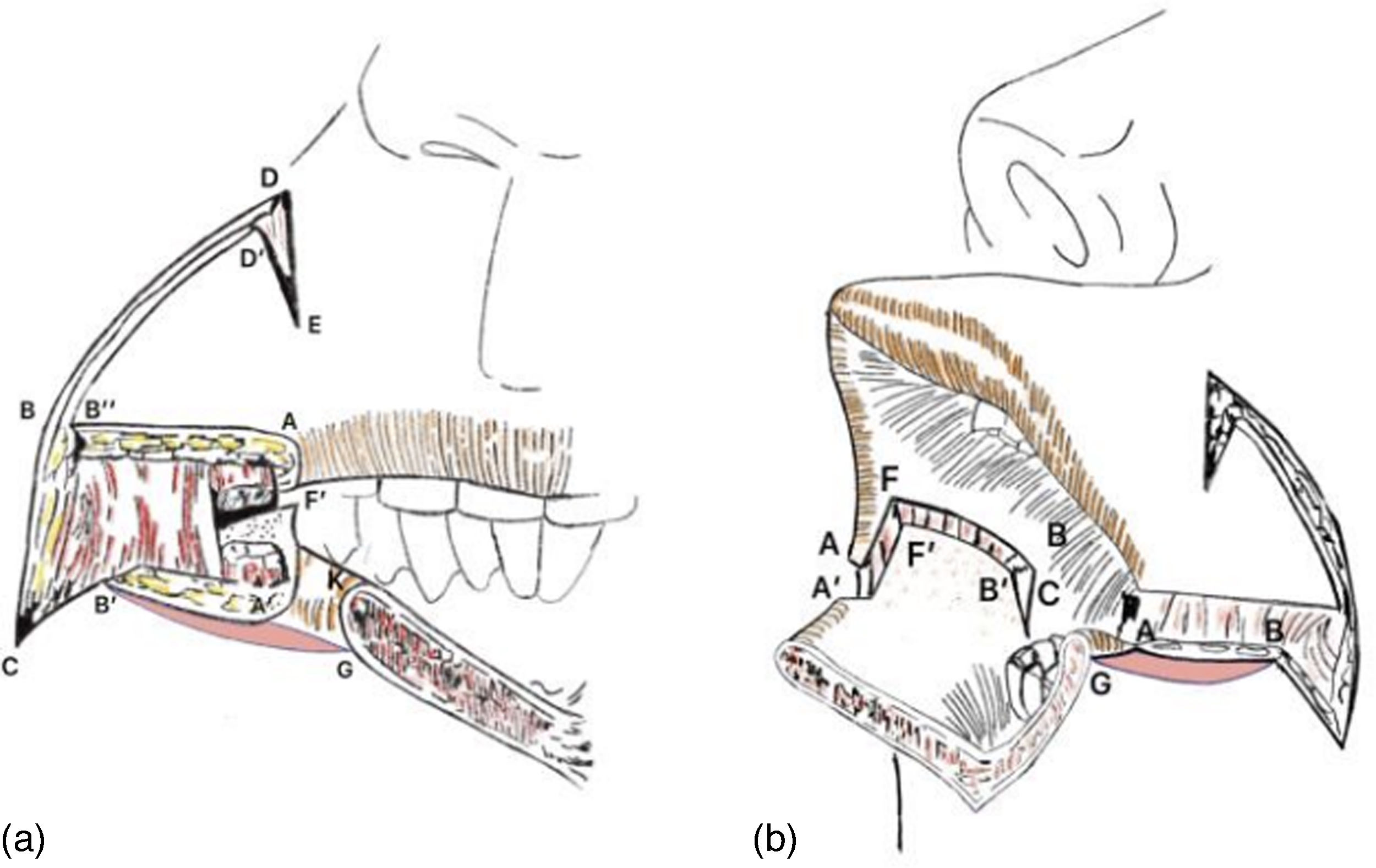 fig0010