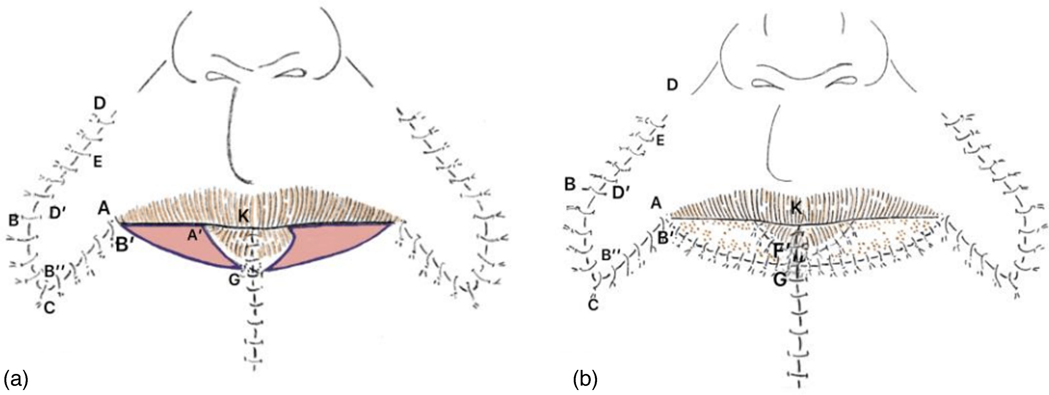 fig0015