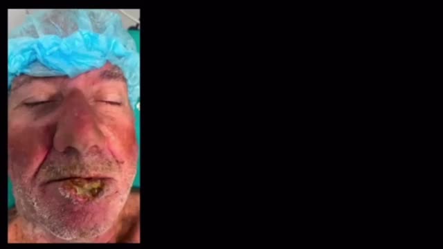 https://ars.els-cdn.com/content/image/1-s2.0-S0001731026000761-mmc1.mp4