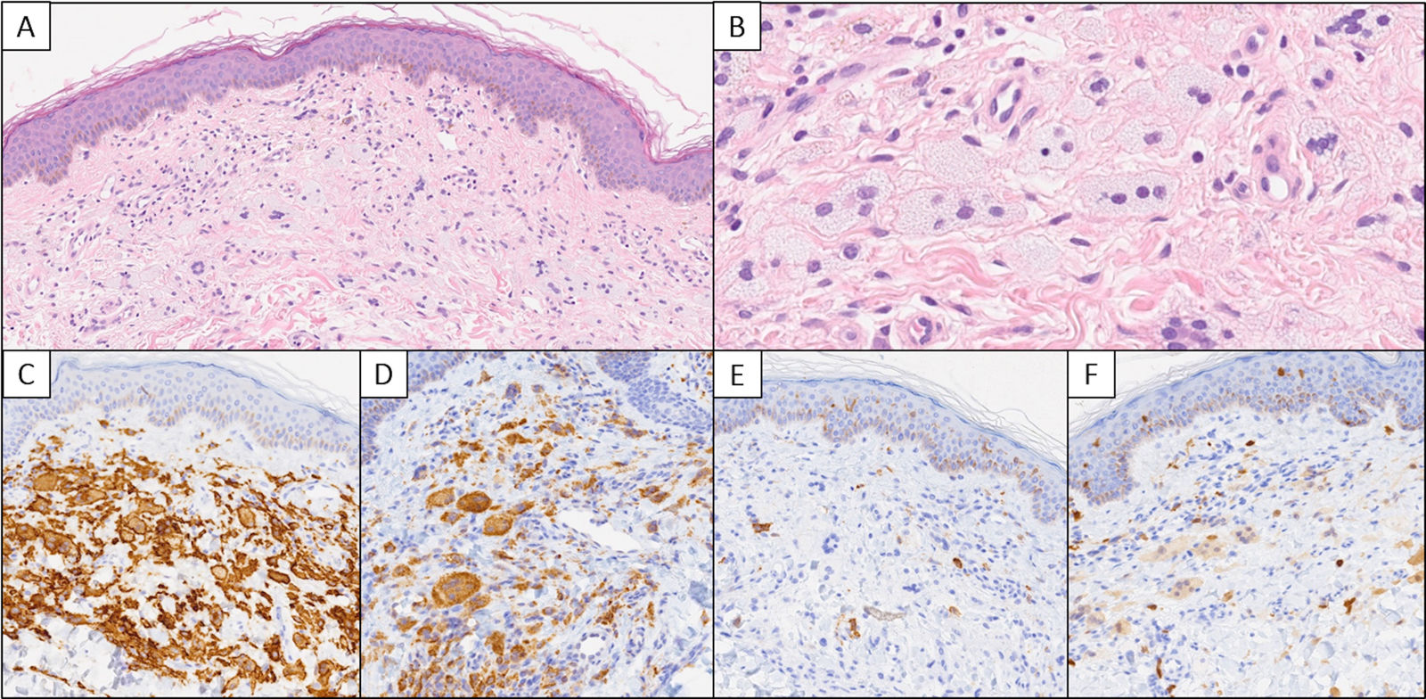 fig0010