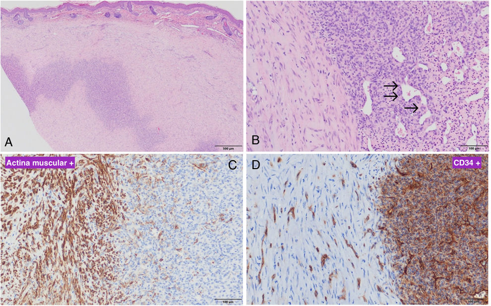 fig0010