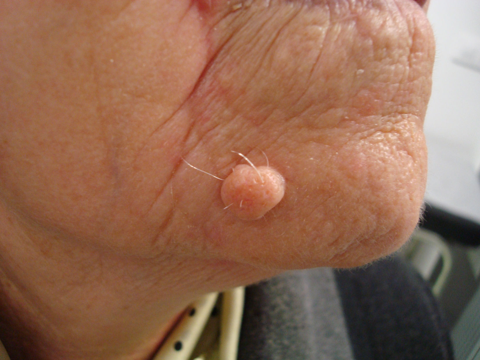fig0030