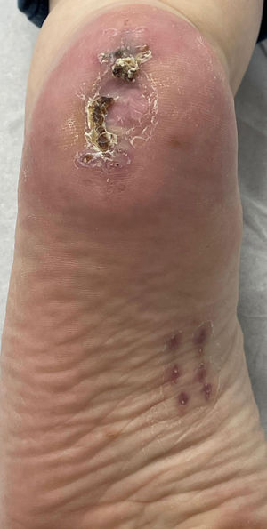 “Postoperative course”. Follow-up at 5 weeks after the procedure.