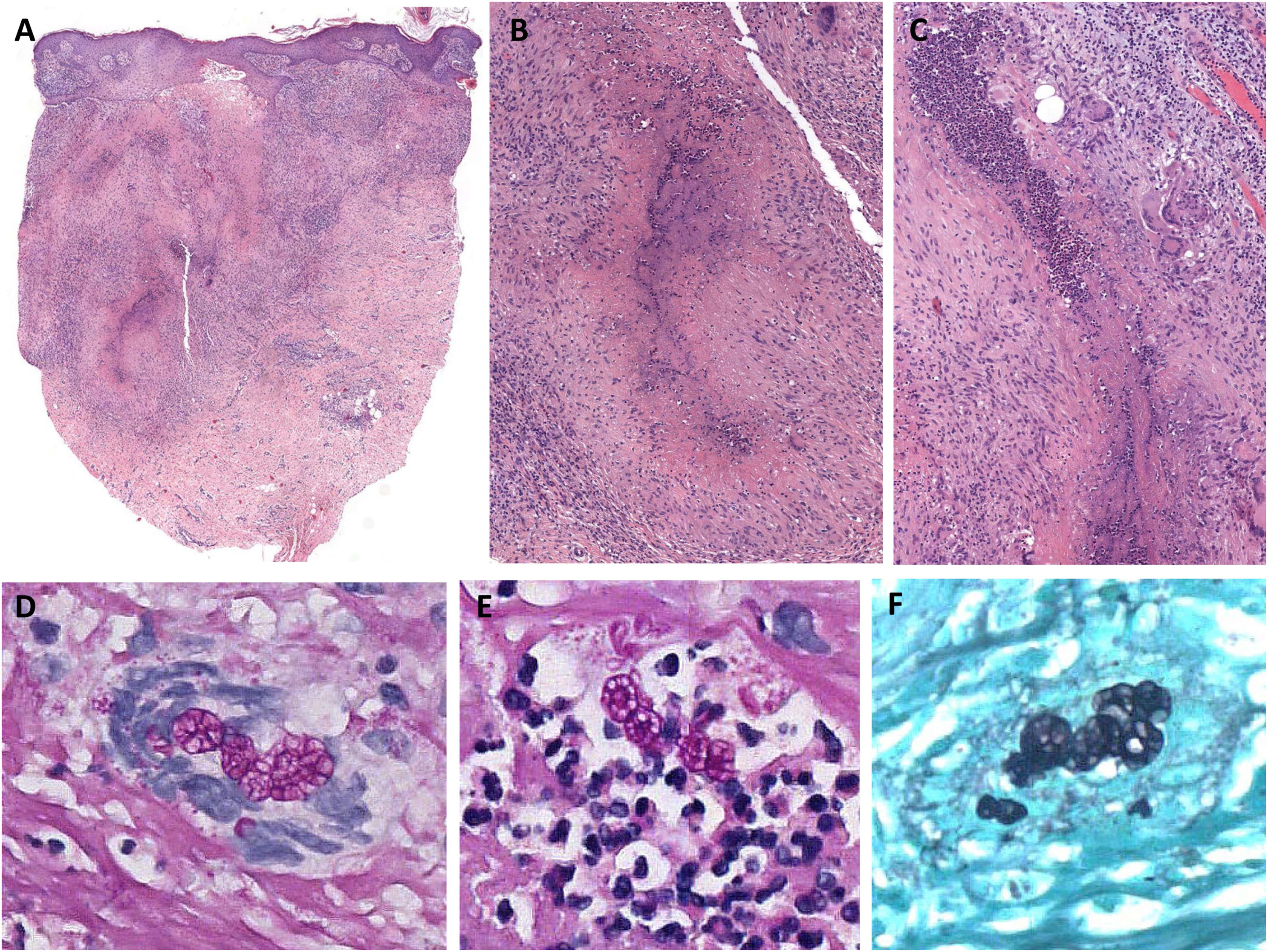 fig0010