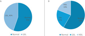 Distribución de los pacientes según la valoración con anoscopia de alta resolución. A) Basal. B) Distribución de los pacientes durante el seguimiento.