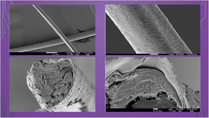 Electron microscopy, “Pili trianguli et canaliculi” (Scientific and Technological Centers, Universitat de Barcelona, Barcelona, Spain).